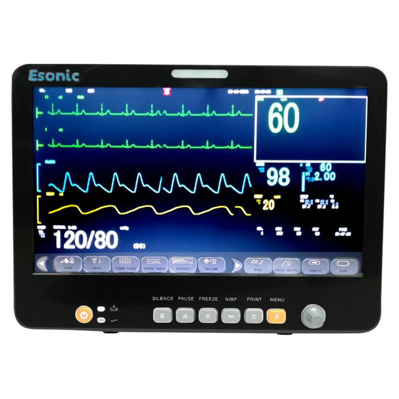 Multi Parameter Patient Monitor (15.6 Inch Display)